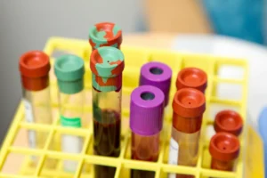 Яка найрідкісніша група крові у світі: золота кров Rh-null та інші унікуми